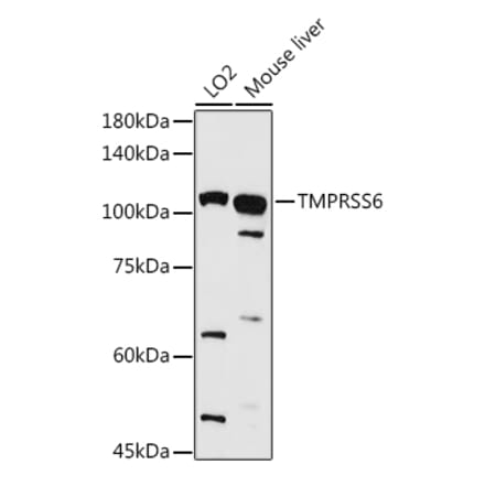 Western Blot - Anti-Matriptase 2 Antibody (A8702) - Antibodies.com