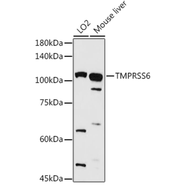 Western Blot - Anti-Matriptase 2 Antibody (A8702) - Antibodies.com