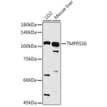 Western Blot - Anti-Matriptase 2 Antibody (A8702) - Antibodies.com