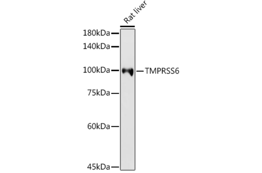 Western Blot - Anti-Matriptase 2 Antibody (A8702) - Antibodies.com