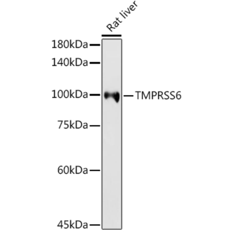 Western Blot - Anti-Matriptase 2 Antibody (A8702) - Antibodies.com