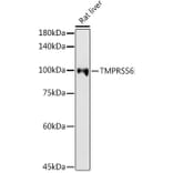 Western Blot - Anti-Matriptase 2 Antibody (A8702) - Antibodies.com