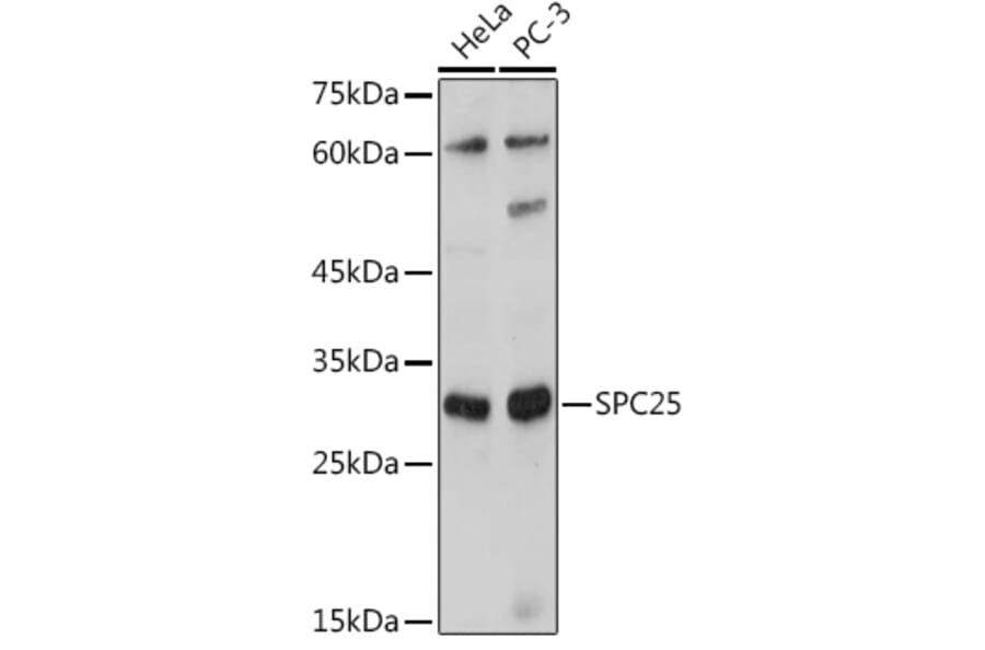 Western Blot - Anti-SPC25 Antibody (A8712) - Antibodies.com