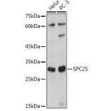Western Blot - Anti-SPC25 Antibody (A8712) - Antibodies.com
