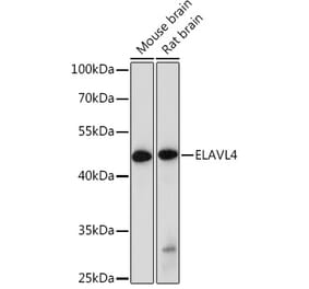 Western Blot - Anti-HuD Antibody (A8714) - Antibodies.com