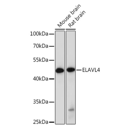 Western Blot - Anti-HuD Antibody (A8714) - Antibodies.com