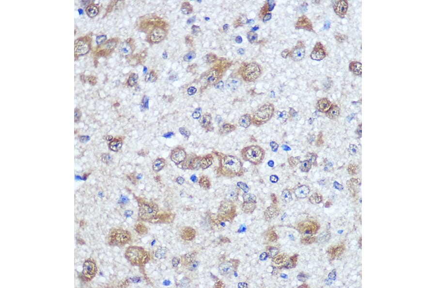 Immunohistochemistry - Anti-HuD Antibody (A8714) - Antibodies.com
