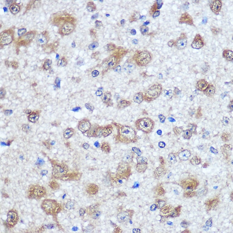 Immunohistochemistry - Anti-HuD Antibody (A8714) - Antibodies.com