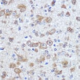 Immunohistochemistry - Anti-HuD Antibody (A8714) - Antibodies.com