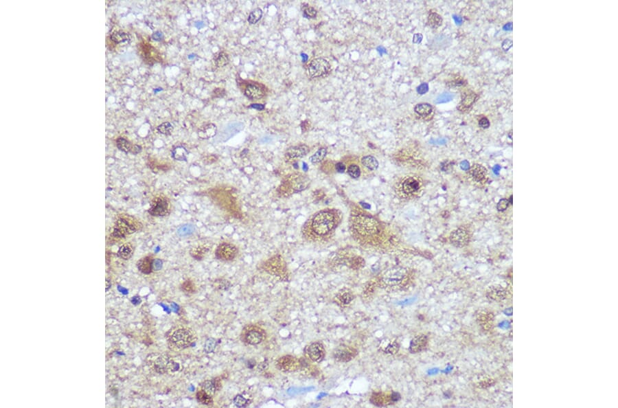 Immunohistochemistry - Anti-HuD Antibody (A8714) - Antibodies.com