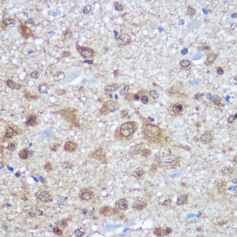 Immunohistochemistry - Anti-HuD Antibody (A8714) - Antibodies.com