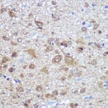 Immunohistochemistry - Anti-HuD Antibody (A8714) - Antibodies.com