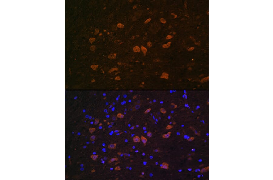 Immunofluorescence - Anti-HuD Antibody (A8714) - Antibodies.com