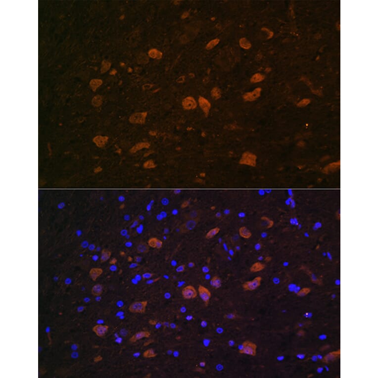 Immunofluorescence - Anti-HuD Antibody (A8714) - Antibodies.com