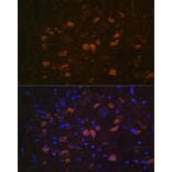 Immunofluorescence - Anti-HuD Antibody (A8714) - Antibodies.com