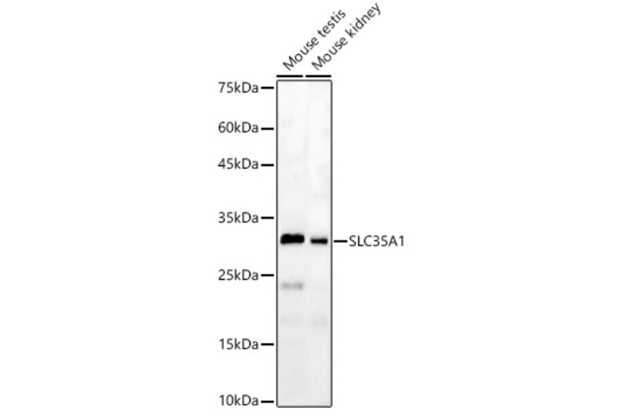 Western Blot - Anti-SLC35A1 Antibody (A8717) - Antibodies.com