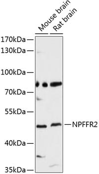 Western blot analysis of extracts of various cell lines, using Anti-NPFFR2 Antibody (A10664) at 1:3000 dilution.
Secondary antibody: Goat Anti-Rabbit IgG (H+L) (HRP) (AS014) at 1:10,000 dilution.
Lysates / proteins: 25µg per lane.
Blocking buffer: 3% non-fat dry milk in TBST.
Detection: ECL Basic Kit (RM00020).
Exposure time: 90s.