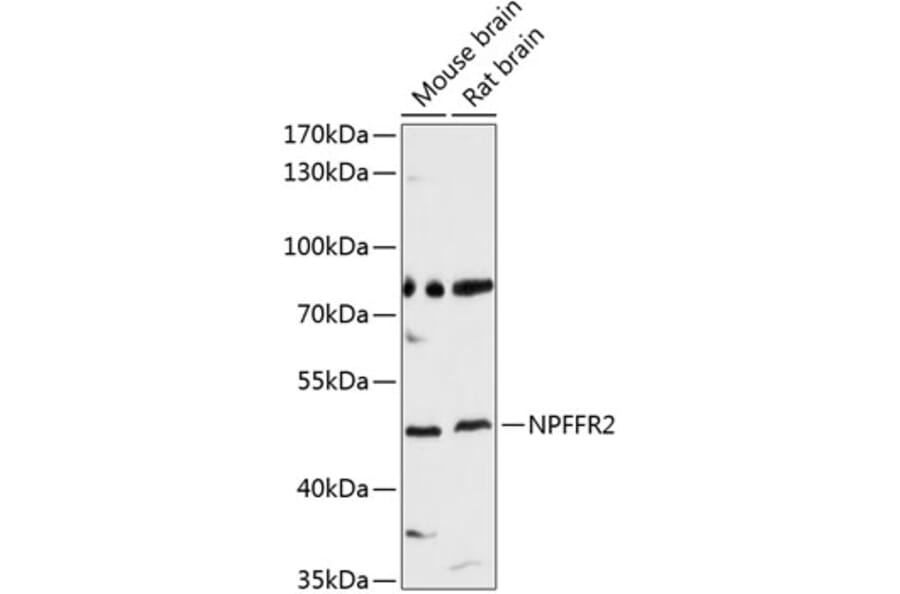 Western Blot - Anti-NPFF2 Receptor Antibody (A8723) - Antibodies.com
