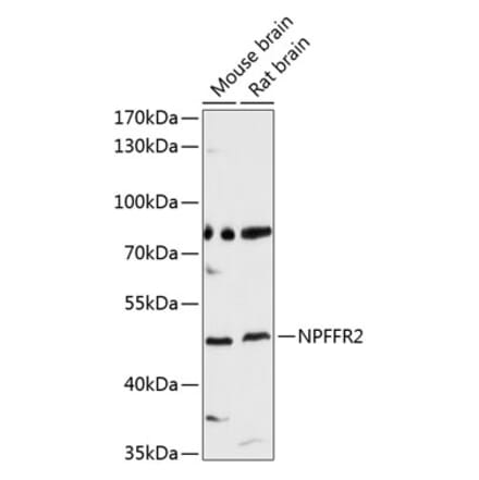 Western Blot - Anti-NPFF2 Receptor Antibody (A8723) - Antibodies.com