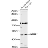Western Blot - Anti-NPFF2 Receptor Antibody (A8723) - Antibodies.com