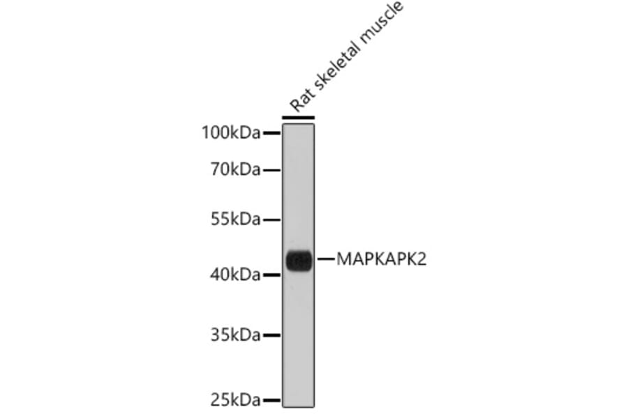 Western Blot - Anti-MK2 Antibody (A8727) - Antibodies.com