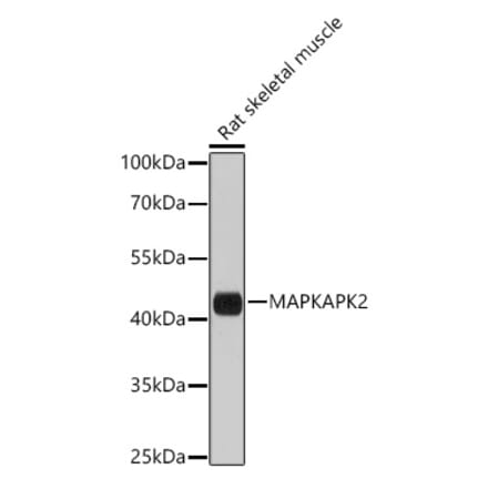 Western Blot - Anti-MK2 Antibody (A8727) - Antibodies.com