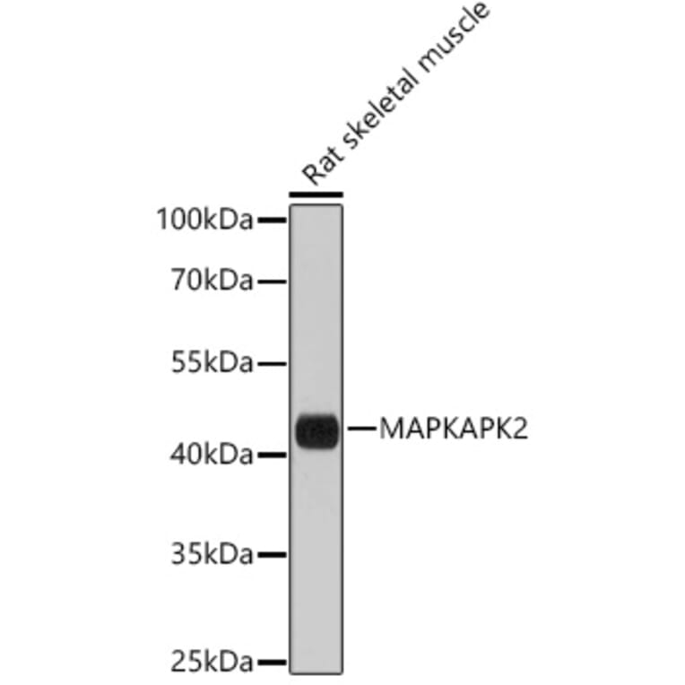 Western Blot - Anti-MK2 Antibody (A8727) - Antibodies.com
