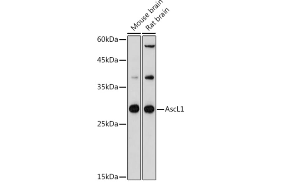 Western Blot - Anti-MASH1/Achaete-scute homolog 1 Antibody (A8728) - Antibodies.com