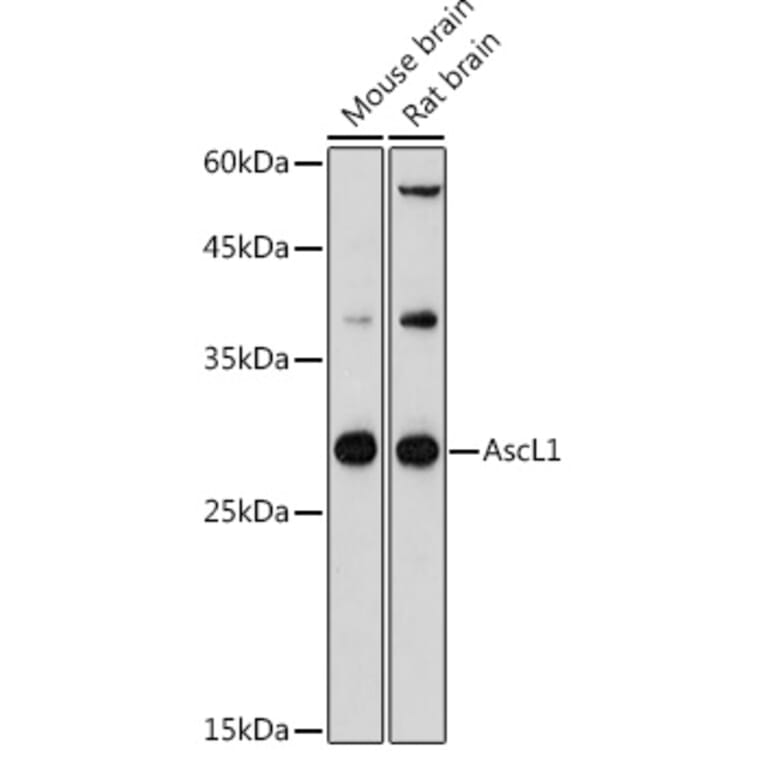 Western Blot - Anti-MASH1/Achaete-scute homolog 1 Antibody (A8728) - Antibodies.com