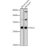 Western Blot - Anti-MASH1/Achaete-scute homolog 1 Antibody (A8728) - Antibodies.com