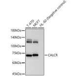 Western Blot - Anti-CT-R Antibody (A8733) - Antibodies.com