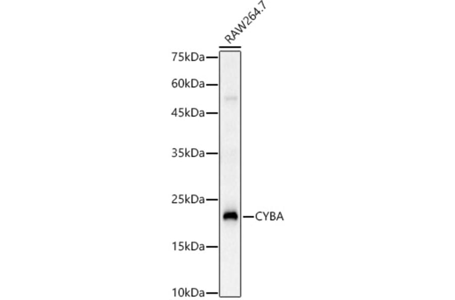 Western Blot - Anti-Cytochrome b245 Light Chain/p22-phox Antibody (A8752) - Antibodies.com