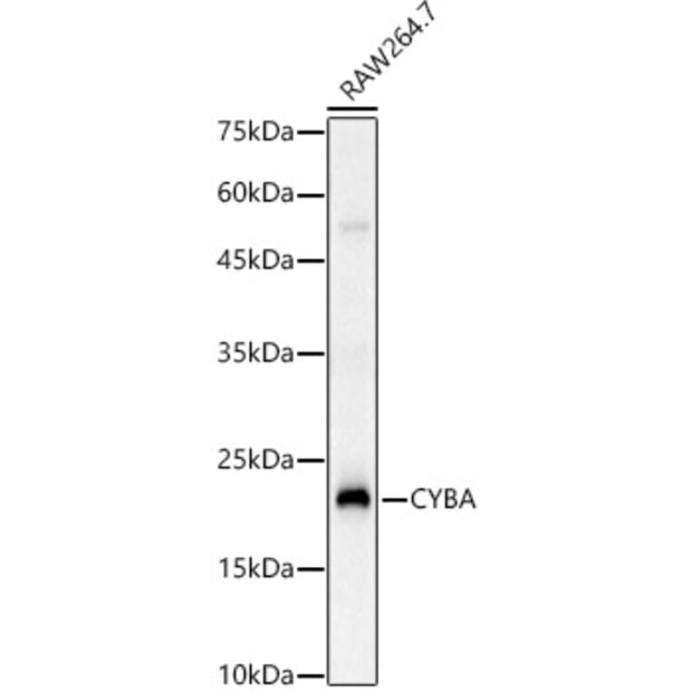 Western Blot - Anti-Cytochrome b245 Light Chain / p22-phox Antibody (A8752) - Antibodies.com