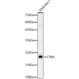 Western Blot - Anti-Cytochrome b245 Light Chain / p22-phox Antibody (A8752) - Antibodies.com