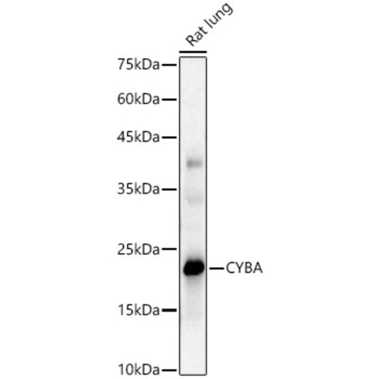 Western Blot - Anti-Cytochrome b245 Light Chain / p22-phox Antibody (A8752) - Antibodies.com