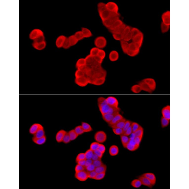 Immunofluorescence - Anti-Cytochrome b245 Light Chain / p22-phox Antibody (A8752) - Antibodies.com