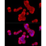 Immunofluorescence - Anti-Cytochrome b245 Light Chain / p22-phox Antibody (A8752) - Antibodies.com