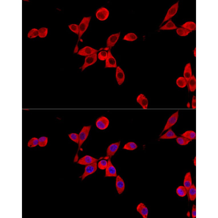 Immunofluorescence - Anti-Cytochrome b245 Light Chain / p22-phox Antibody (A8752) - Antibodies.com