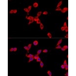 Immunofluorescence - Anti-Cytochrome b245 Light Chain / p22-phox Antibody (A8752) - Antibodies.com