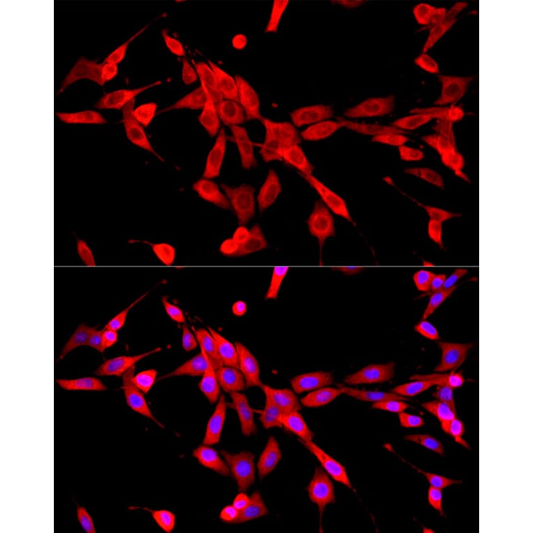 Immunofluorescence - Anti-Cytochrome b245 Light Chain / p22-phox Antibody (A8752) - Antibodies.com