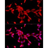 Immunofluorescence - Anti-Cytochrome b245 Light Chain / p22-phox Antibody (A8752) - Antibodies.com