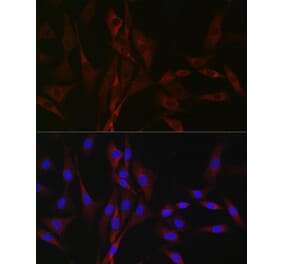 Immunofluorescence - Anti-CACNA1H Antibody (A8755) - Antibodies.com