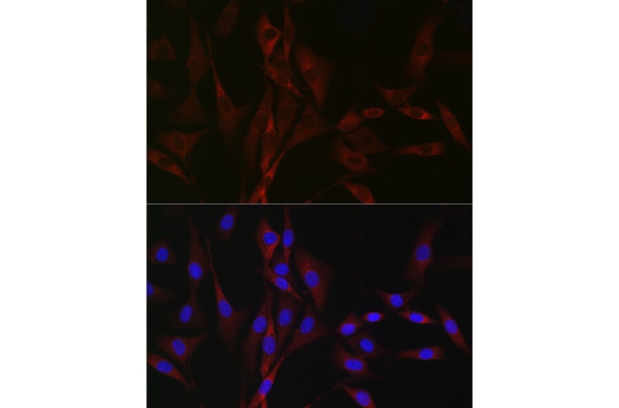Immunofluorescence - Anti-CACNA1H Antibody (A8755) - Antibodies.com