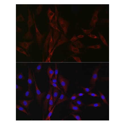 Immunofluorescence - Anti-CACNA1H Antibody (A8755) - Antibodies.com