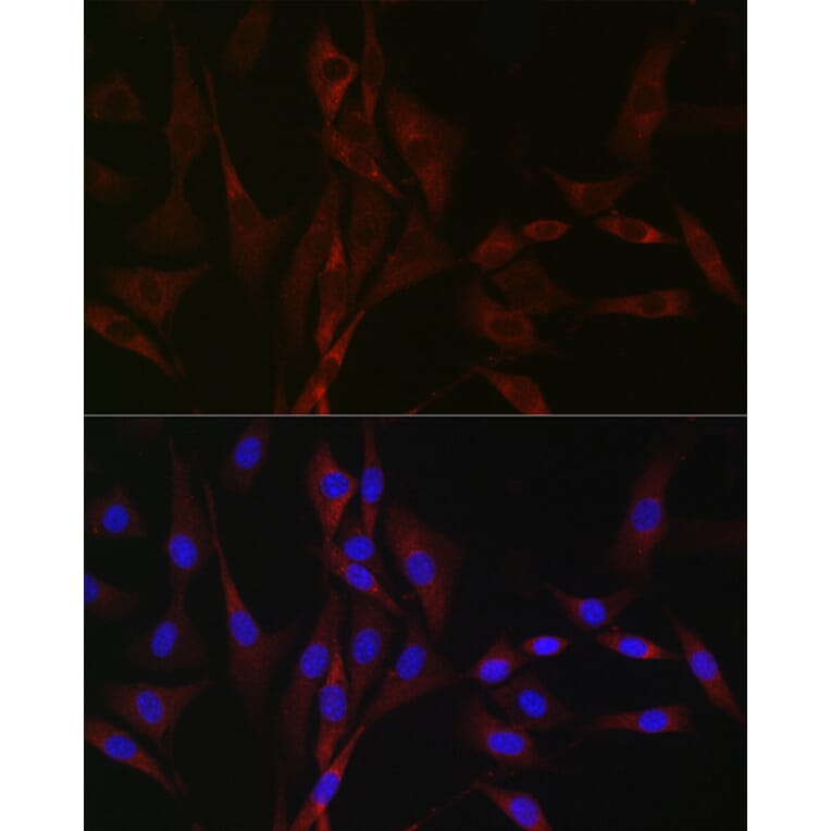 Immunofluorescence - Anti-CACNA1H Antibody (A8755) - Antibodies.com