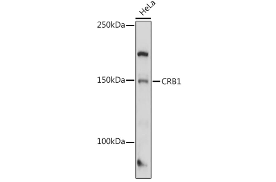 Western Blot - Anti-CRB1 Antibody (A8756) - Antibodies.com