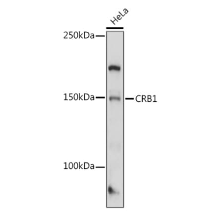 Western Blot - Anti-CRB1 Antibody (A8756) - Antibodies.com