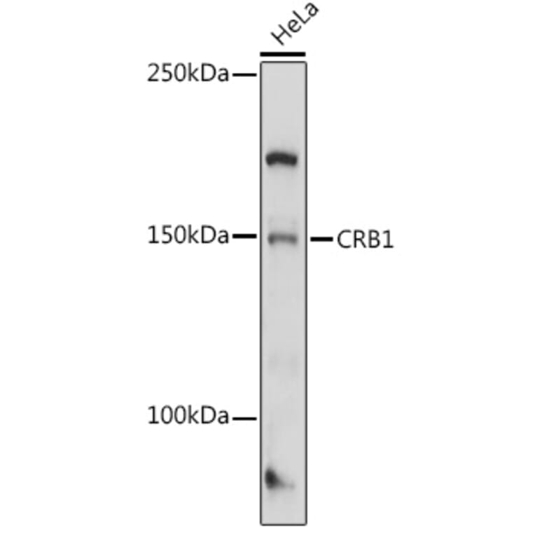 Western Blot - Anti-CRB1 Antibody (A8756) - Antibodies.com