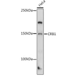 Western Blot - Anti-CRB1 Antibody (A8756) - Antibodies.com