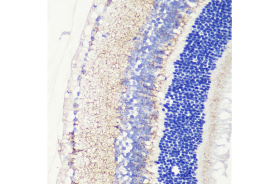 Immunohistochemistry - Anti-CRB1 Antibody (A8756) - Antibodies.com